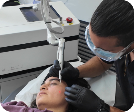 Extracción de Lunares